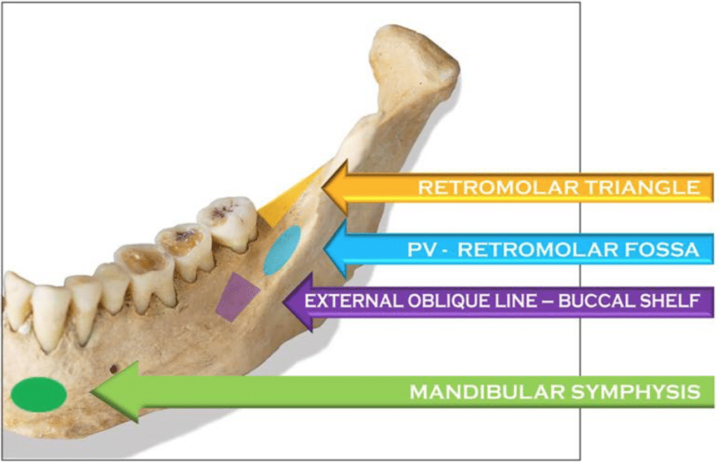 oblique ridge mandible